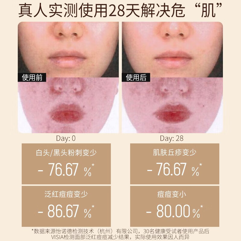 老中医痘清洗面奶 弱酸性洁面乳 减少毛孔阻塞并缓减痘痘生长清爽不紧绷 痘清洗面奶120g