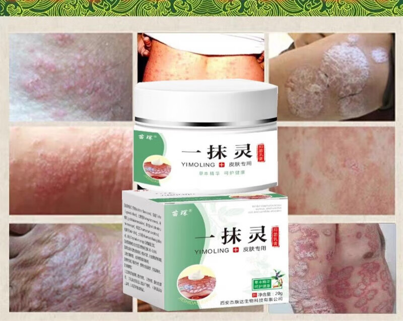 芙医草本一抹灵膏宛苑医堂湿毒康芙乐草本肤乳膏乐芙湿毒清 乐芙