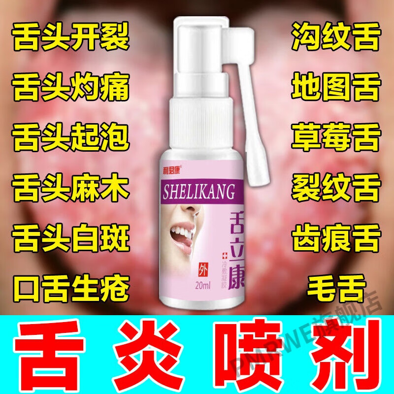 舌立康舌炎喷剂舌头开裂舌裂纹舌发白舌苔有舌痕麻木起泡灼痛喷剂 1