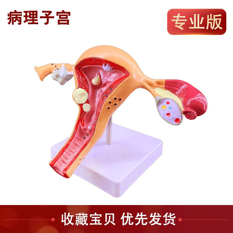 子宫模型 卵巢 女性内外生殖器官模型 生殖科妇科演示 病理子宫