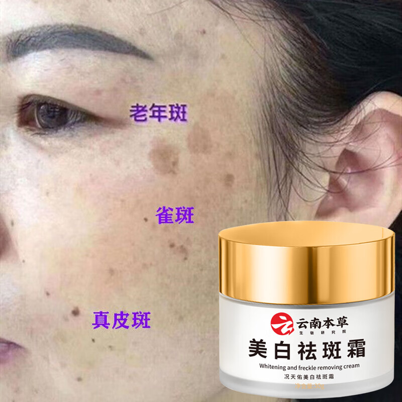 倾姿堂云南本草美白祛斑霜老年斑黄褐斑雀斑孕斑遗传斑晒斑霜男女30g