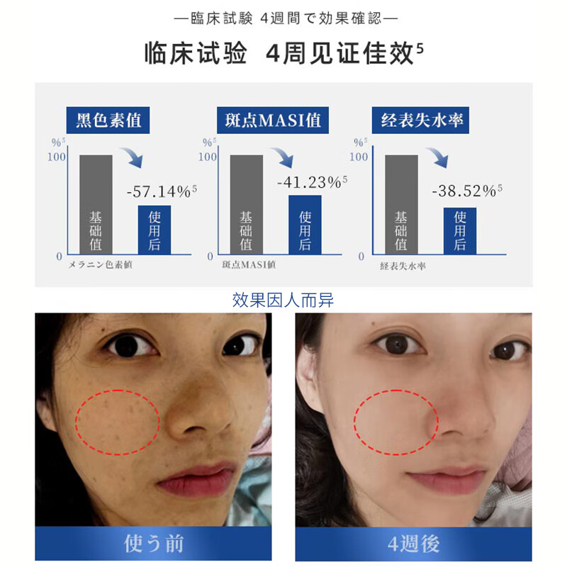 H18美白祛斑面膜美白补水淡斑提亮肤色女男士收缩毛孔淡化痘印5片装