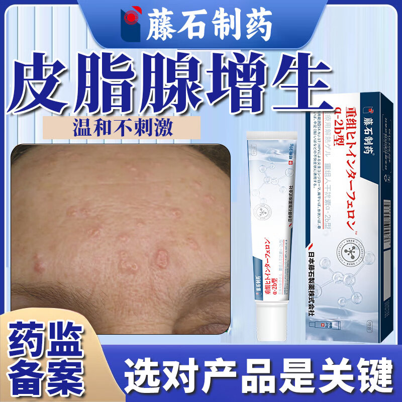 皮脂腺增生异位症专用特傚效膏额头私处囊肿凸起疙瘩皮下痘痘粉瘤药监