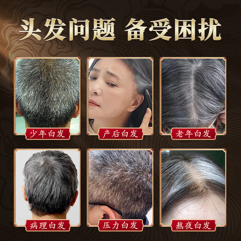 香港大药房育发丸毛囊滋养长/发养护改善掉发秃头全秃脱发白发/变黑养护发 【23盒家庭装】秃头人自救
