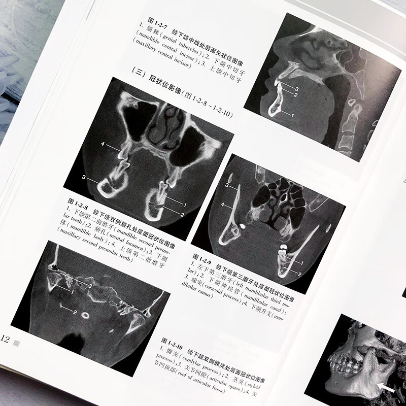 口腔临床cbct影像诊断学 口腔颌面锥形束ct医学影像诊断学 现代口腔