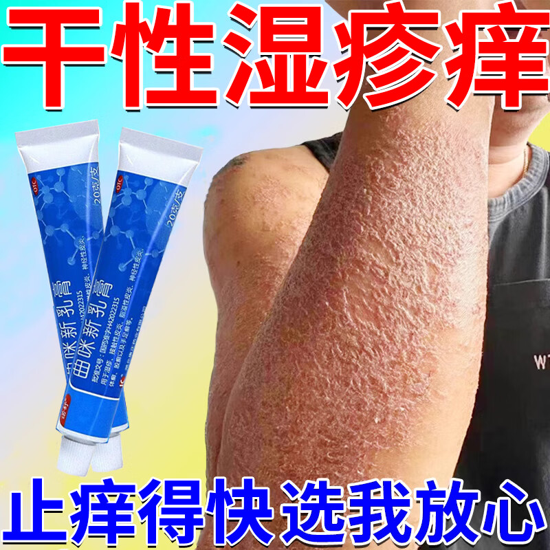 神经性皮炎专用药 皮肤剧烈瘙痒皮炎湿疹皮癣真菌感染止痒膏 皮肤用药皮肤瘙痒抓出血 曲咪新乳膏 1盒装