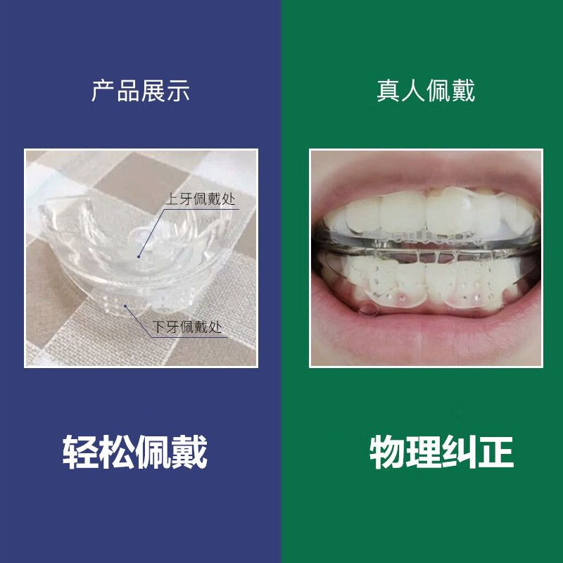 嘴巴歪矫正器歪嘴矫正器不对称脸歪纠正下颚前移器下颚凸嘴矫正器