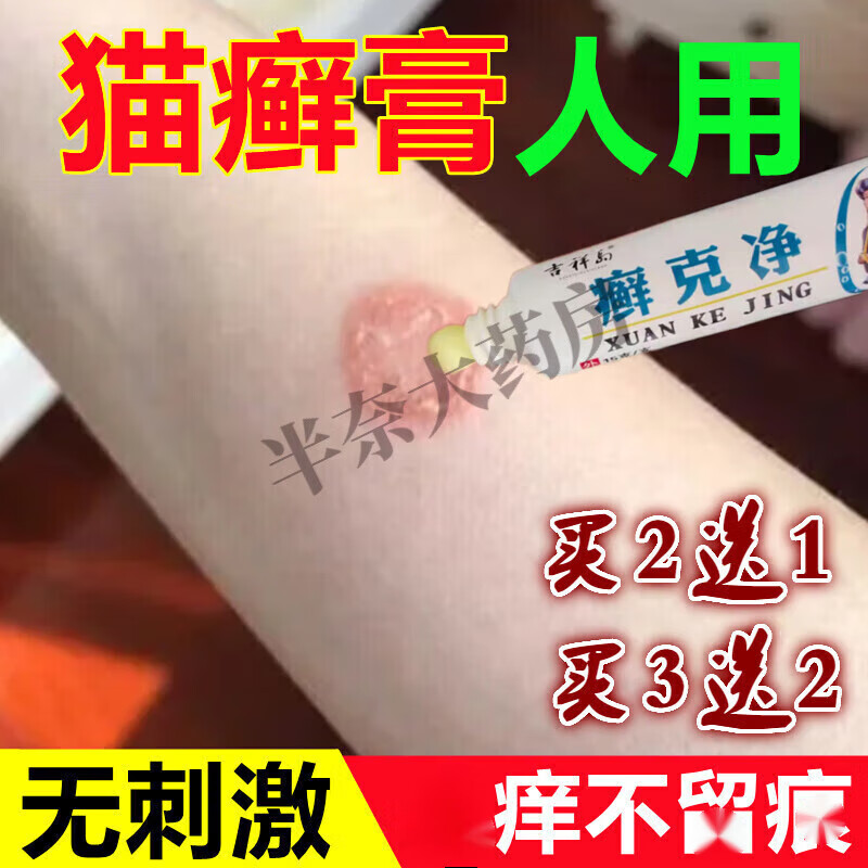 【药房直售】猫癣人专用人患猫藓狗癣真菌感染皮肤病痒止消肿去皮 盒