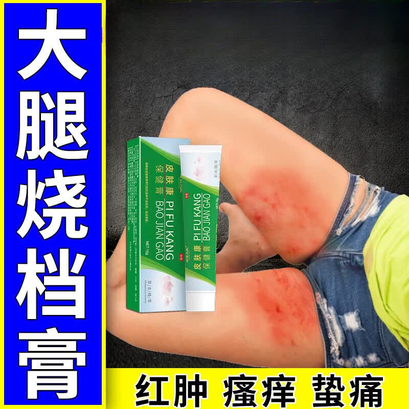 邹润安烧档膏大腿内侧皮肤瘙痒烧档男女士肥胖大腿内侧摩擦红肿瘙痒