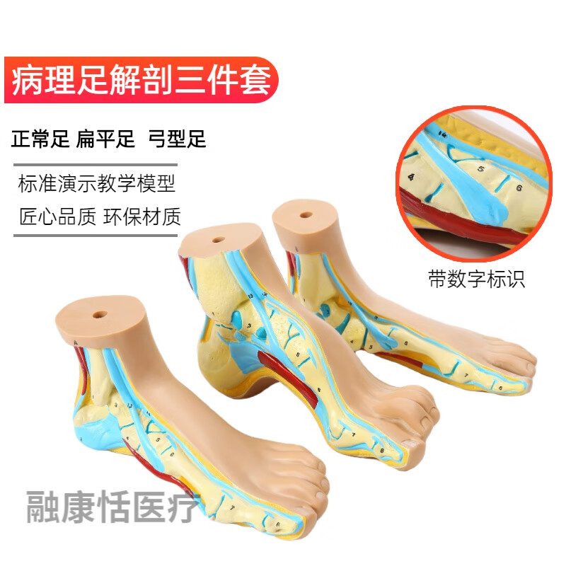 陇聚福弓形足模型 正常足 扁平足 弓型足 模型 足部病理模型人体足部