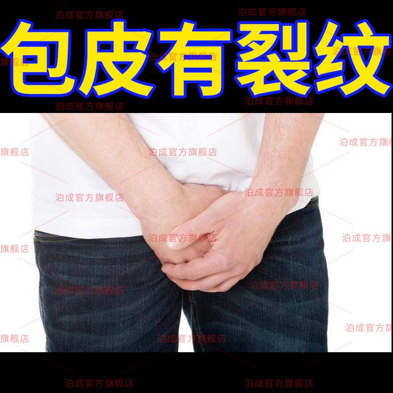 南京同仁堂包皮裂纹包皮裂口包皮焱干燥开裂皲裂纹红肿脱皮干痒白垢