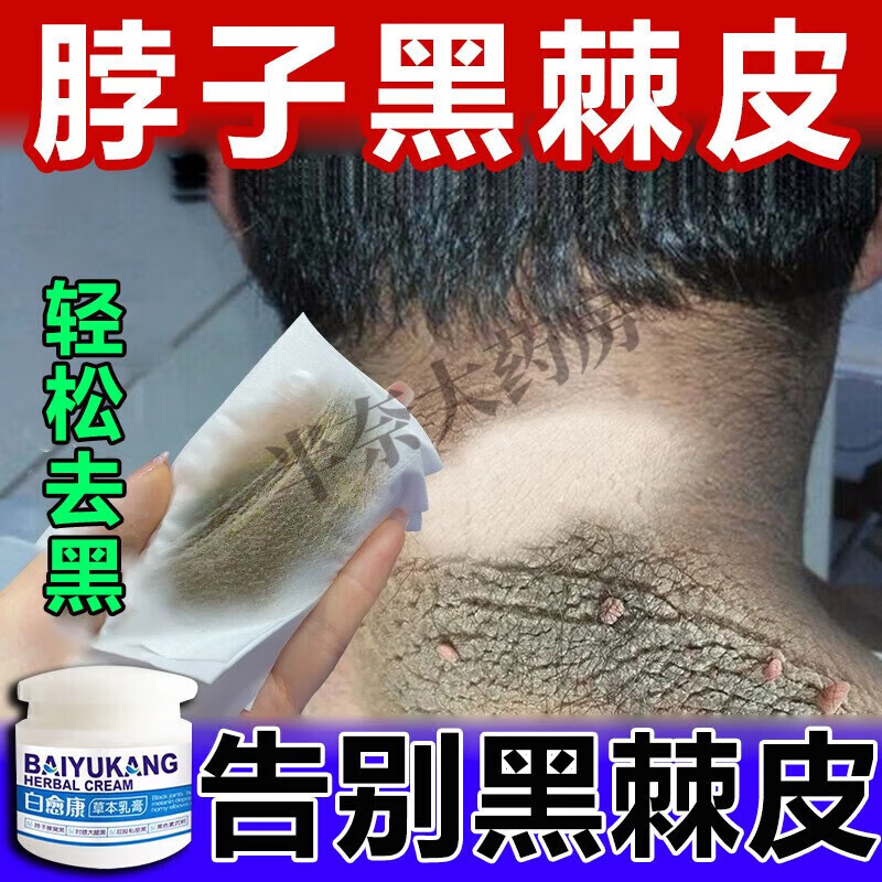 黑棘皮病治脖子全身脸部腋下私处粉嫩淡化黑色素沉淀去除晒黑修复 一