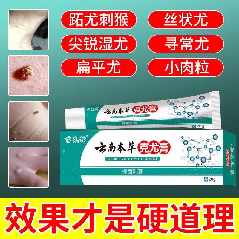 云南本草克疣膏草本克尤膏草木优膏脖子肉粒丝状疣祛尤膏脸上扁平优