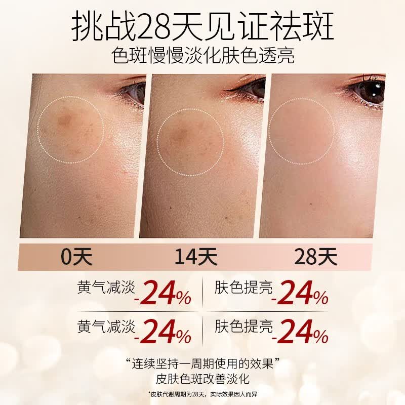 温美泉美白淡斑肤水祛斑去黄提亮改善暗沉水乳美白清爽控油补水保湿女 美白淡斑水乳(爽肤水+乳液)