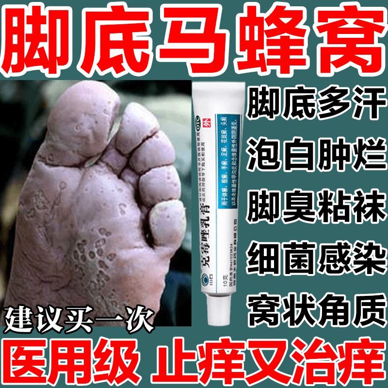 川石 克霉唑乳膏 治脚气脚出汗脚底发白药膏 窝状角质松解症脚底马