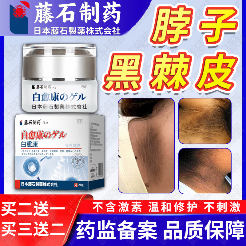 脖子黑色素去除沉淀脖子黑黑的黑棘皮病治脖子黑色素非药的膏qs 小