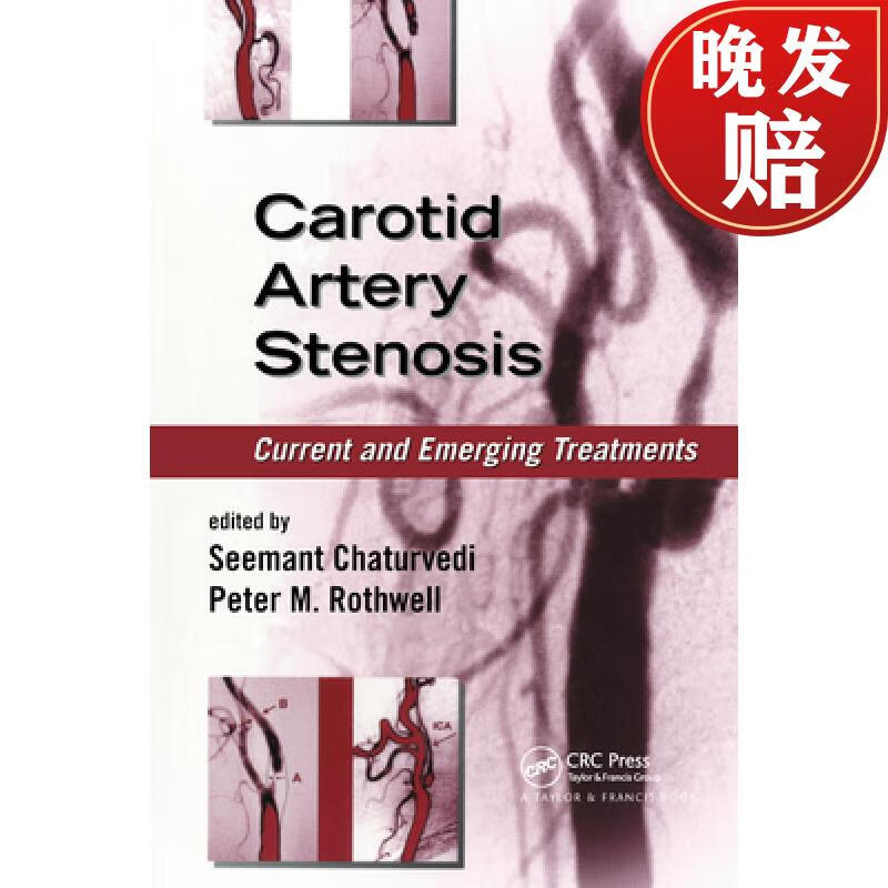【4周达】carotid artery stenosis: current and emerging