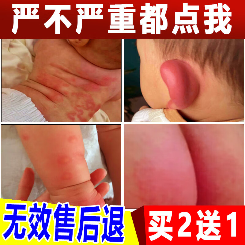 御夫清 紫草膏婴儿蚊虫叮咬止痒消肿皮肤瘙痒晕车护肤婴儿护臀膏屁屁