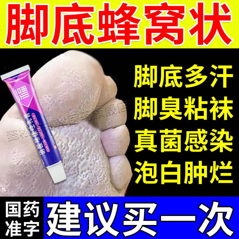 治脚气脚出汗脚底蜂窝状专用药膏 窝状角质松解症脚底发白脱皮水泡