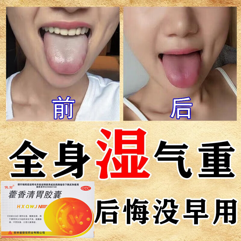 湿气重吃什么药 脾胃虚弱去湿气排毒大肚子排体内全身湿寒祛湿排毒