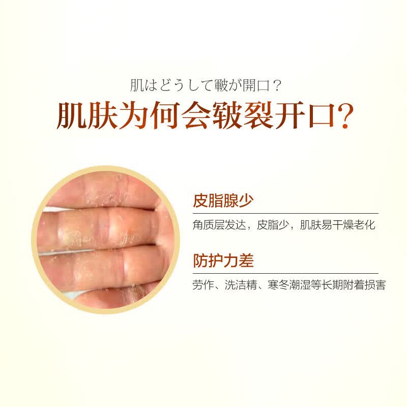 韦香儿马油防裂膏手足裂干裂50g凡士林滋润脚后跟干裂膏龟裂开裂皲裂膏 【三瓶装】马油手足滋润霜 50g/瓶