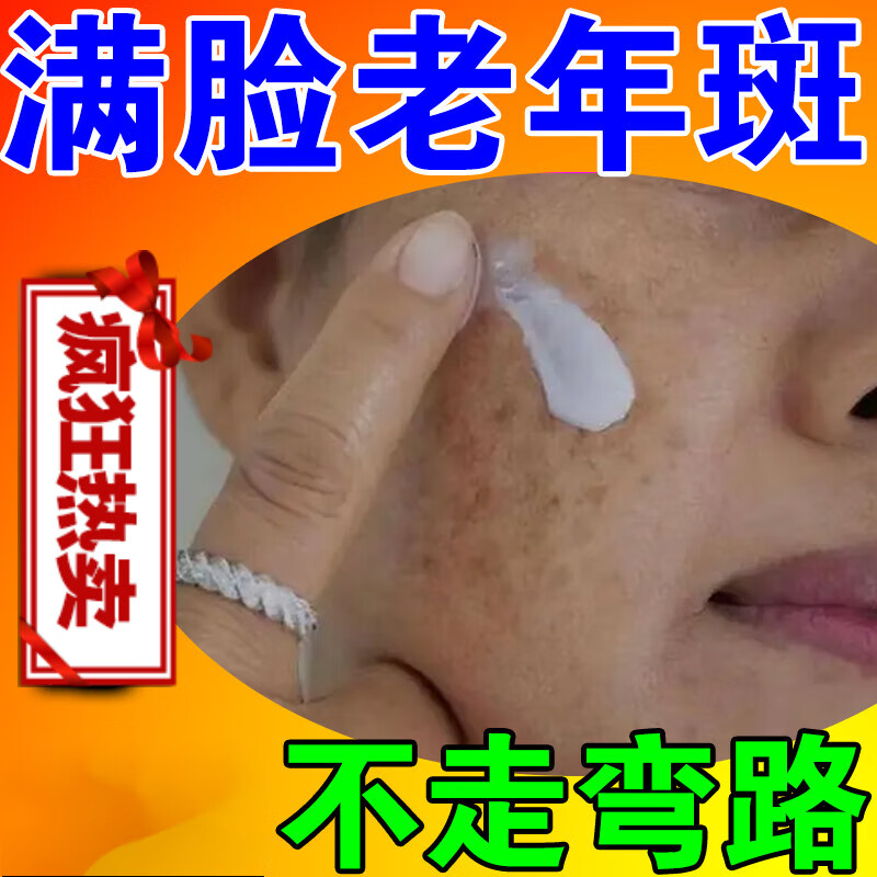 老年斑手部脸部用老人黑斑雀斑晒斑色斑可搭配使用 单盒