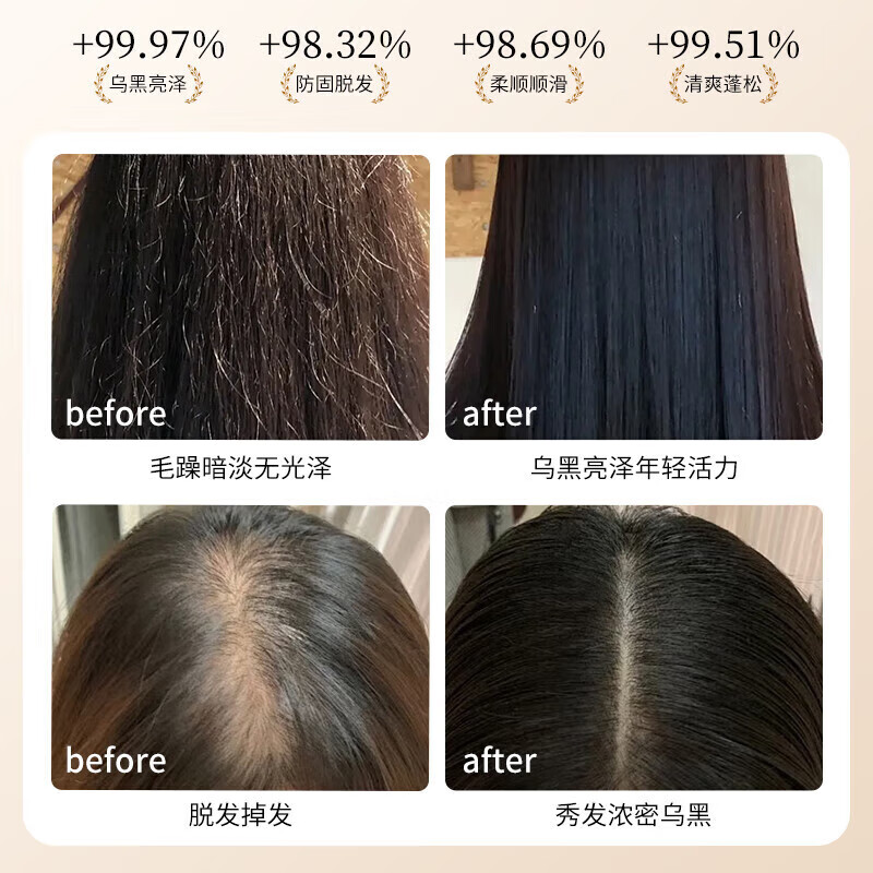 黛青丝防脱育发洗发水官方固发露防断发增长头发膏旗舰控油去屑男女士店 2瓶装840ml【防脱发固发柔顺】
