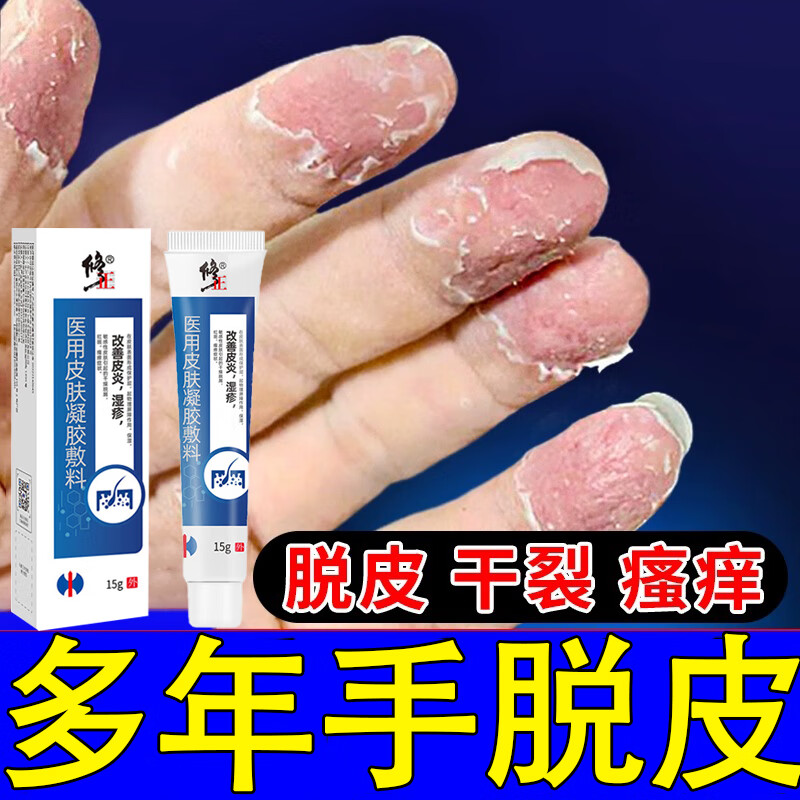 修正手i癣真i菌感染软膏手掌粗糙变厚鹅i掌风手足i癣症脱皮开裂皲裂膏
