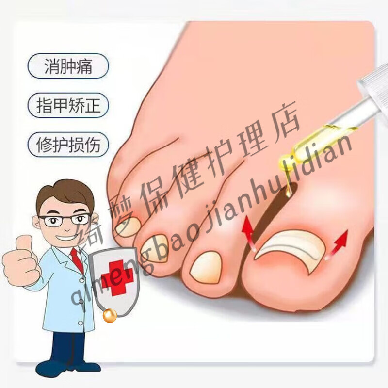 【jd大药房同款直售】甲卫士治甲沟炎嵌甲镇痛甲沟红肿疼痛消肉芽化脓