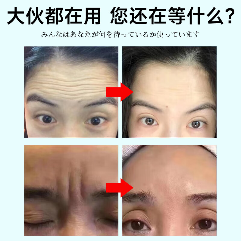 H18抬头纹贴去除男女士额头川字纹皱纹贴法令纹提拉紧致30片装