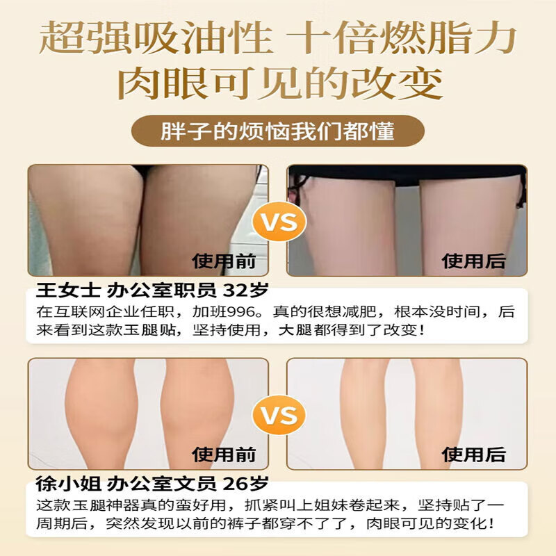 南京同仁堂美腿瘦腿神器大腿小腿粗腿减大象腿根部消除脂肪肌肉燃脂贴  买二赠一
