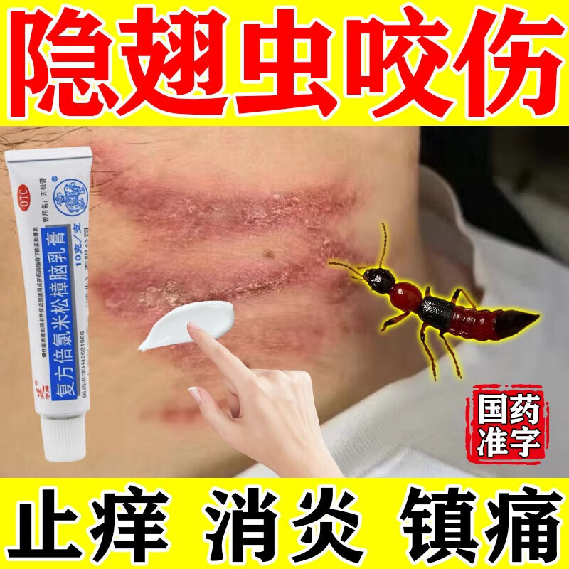 隐翅虫药膏 蚊虫叮咬止痒消肿药膏 治虫咬皮炎水疱糜烂瘙痒灼热疼痛的