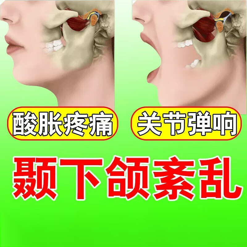 颞下颌关节紊乱矫正理疗热敷贴适用于关节炎大小脸矫正张口疼痛颞颌骨