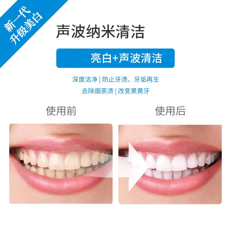 碧缇福2025年新款无线美牙亮白牙齿蓝光冷光仪美白牙神器凝胶去除黄牙渍 无线美牙仪+凝胶5支+赠牙粉牙膏美笔