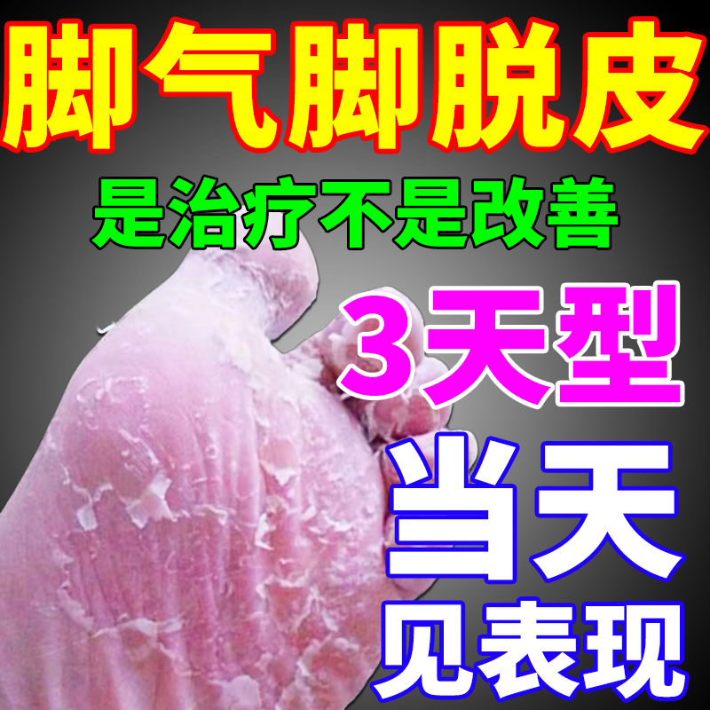 脚丫真菌感染环吡酮胺乳膏(视觉图特效成人专用 1盒【脚底干燥粗糙】