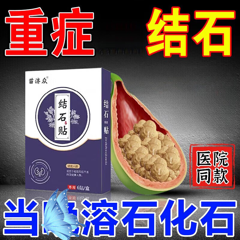 大医生优克龙日本原装进口肾结石碎石苗药排石京東尿路 1瓶【初效装】