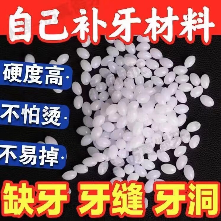 ONE DROP ONLY补牙临时假牙树脂补牙缝填缝剂补牙材料假牙 颜色【可调整】 约308粒【补15颗牙】高硬度