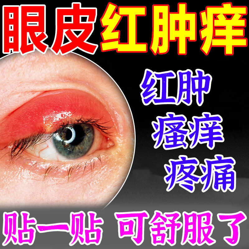 眼皮红肿痒眼睛周围过敏发痒干涩板腺疏通消除散粒肿眼膏 单盒装