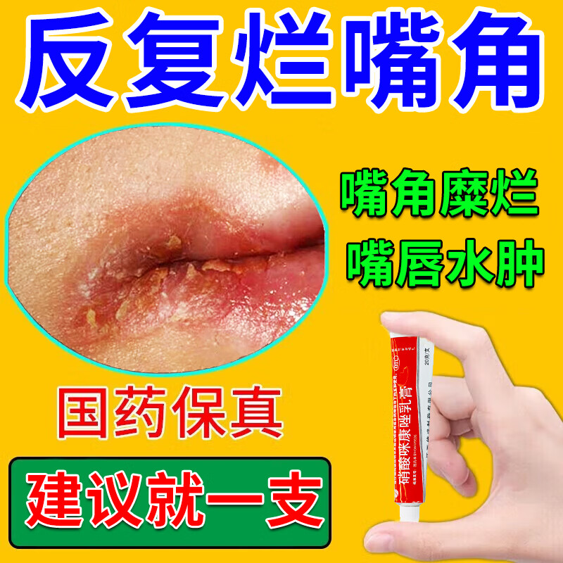 烂嘴角口角炎药膏 嘴角干裂疼痛上火起泡烂嘴角 红肿出血干裂糜烂结痂