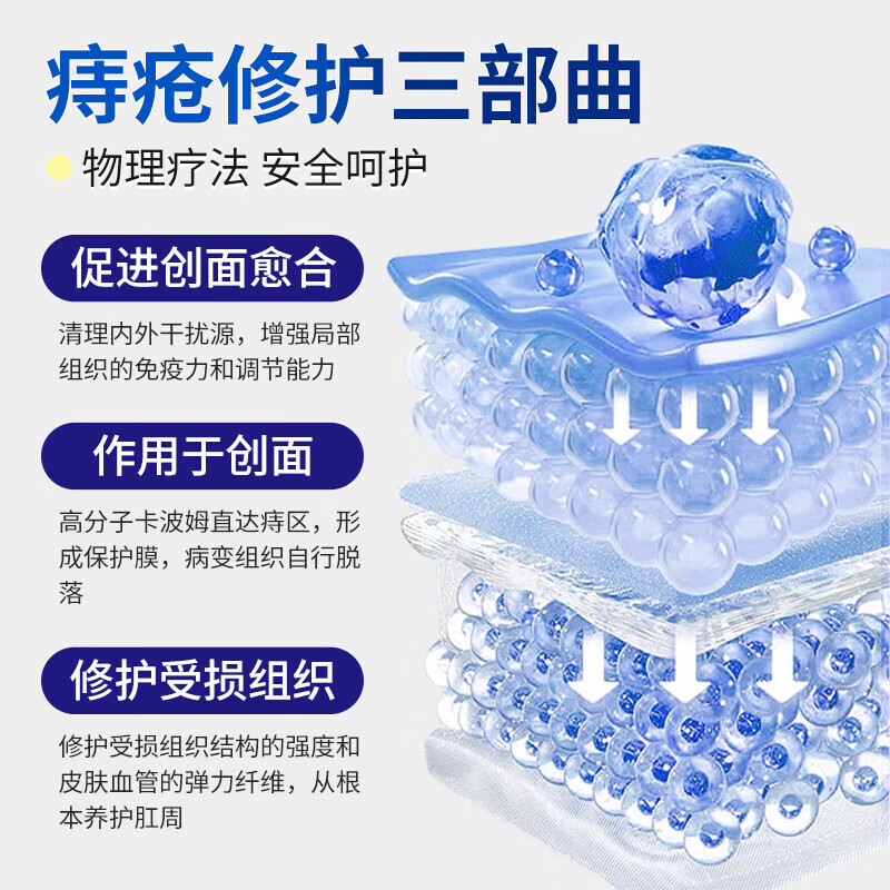 思恩腾瑞贝安痔疮膏肉球凝胶卡波姆痔肉球内外混合痔肛门坠胀瘙痒肛裂便秘充血 痔疮膏1支