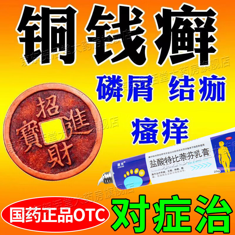 盐酸特比萘芬乳膏 铜钱癣用药膏 治真菌感染引起头癣手癣足癣体癣