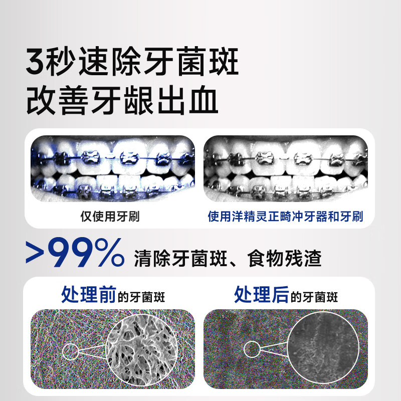 洋精灵冲牙器家用便携儿童电动洗牙仪正畸专用牙结石牙缝清洁-绿色