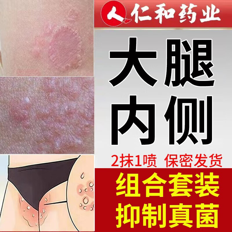 pomada de la campana大腿内侧瘙痒根部潮湿膏男女下身止宁舒痒发变黑