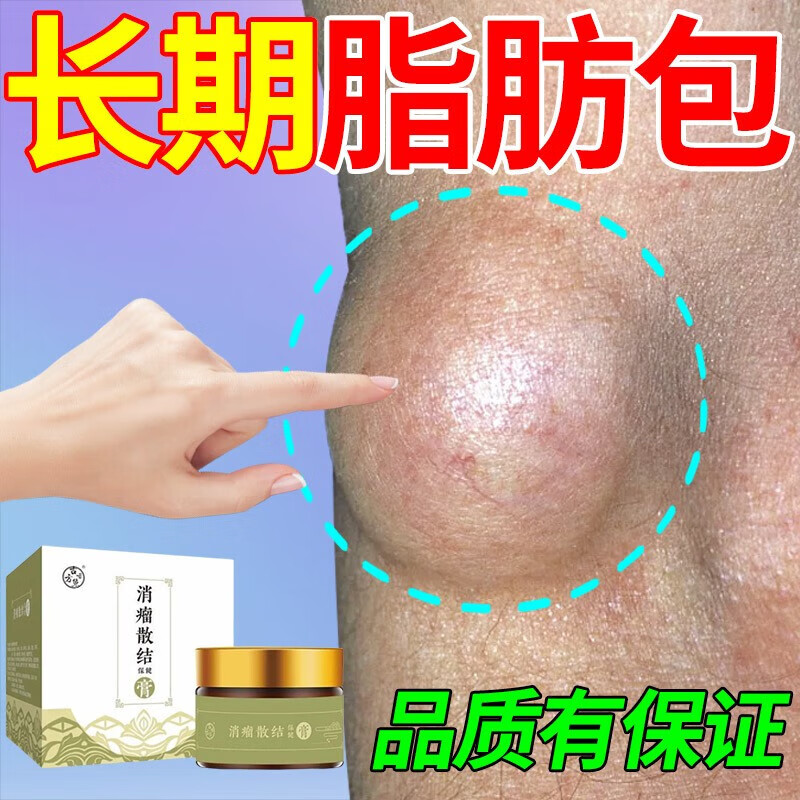 【官方百亿贴】脂肪瘤专用的去除膏脂肪康去除膏脂肪瘤专用3天消专消