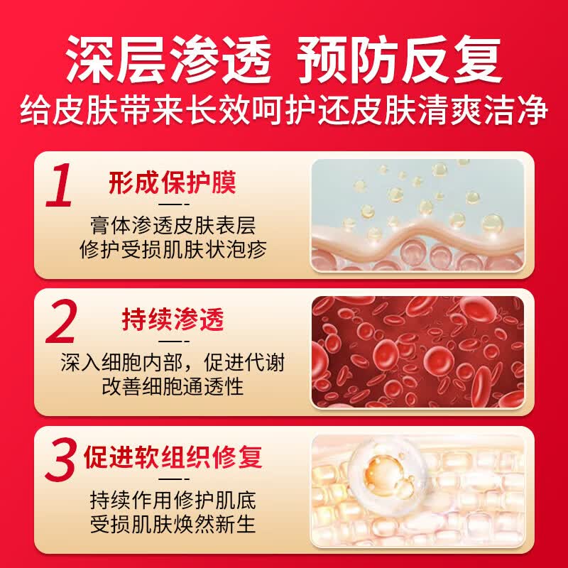 纾大夫阴囊炎阴囊潮湿瘙痒脱皮睾丸瘙痒大腿内侧屁股抑菌止痒膏皮肤瘙痒 双效三盒巩固装