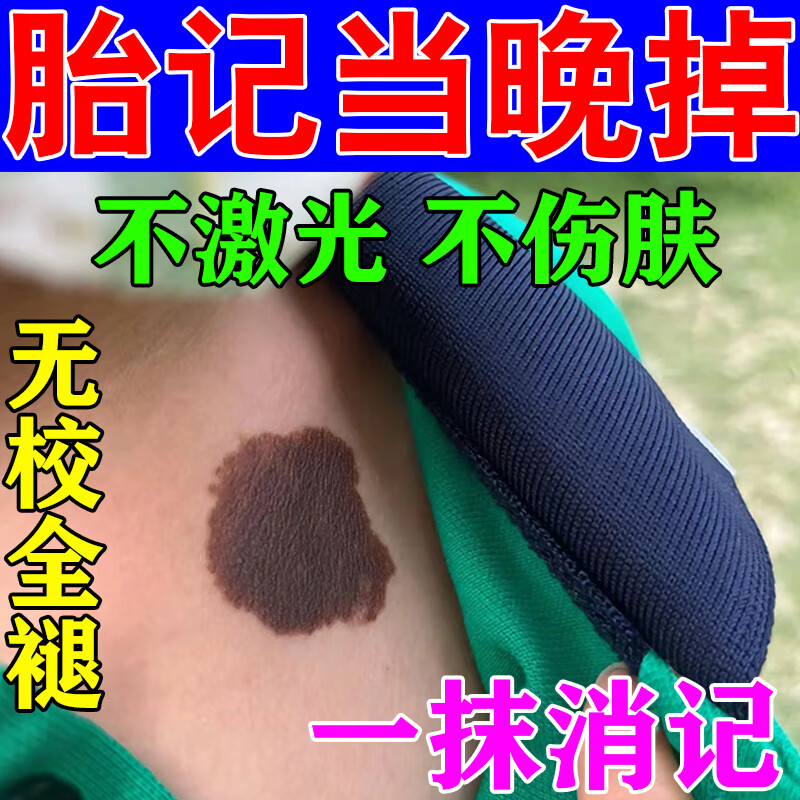 胎记去除神器脸部祛天生胎记淡化太田痣咖啡斑黑色素褐色沉淀 1盒