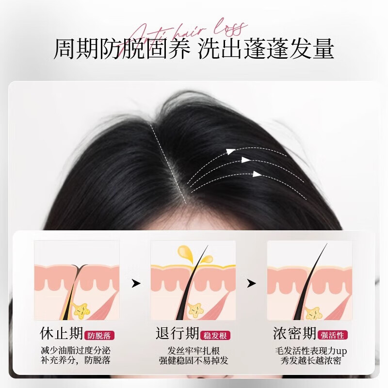 轻奢妍防脱洗发水官方旗舰防脱发固发防断发掉发强韧控油洗发露店 洗发水+白黑客防脱育发液 360ml