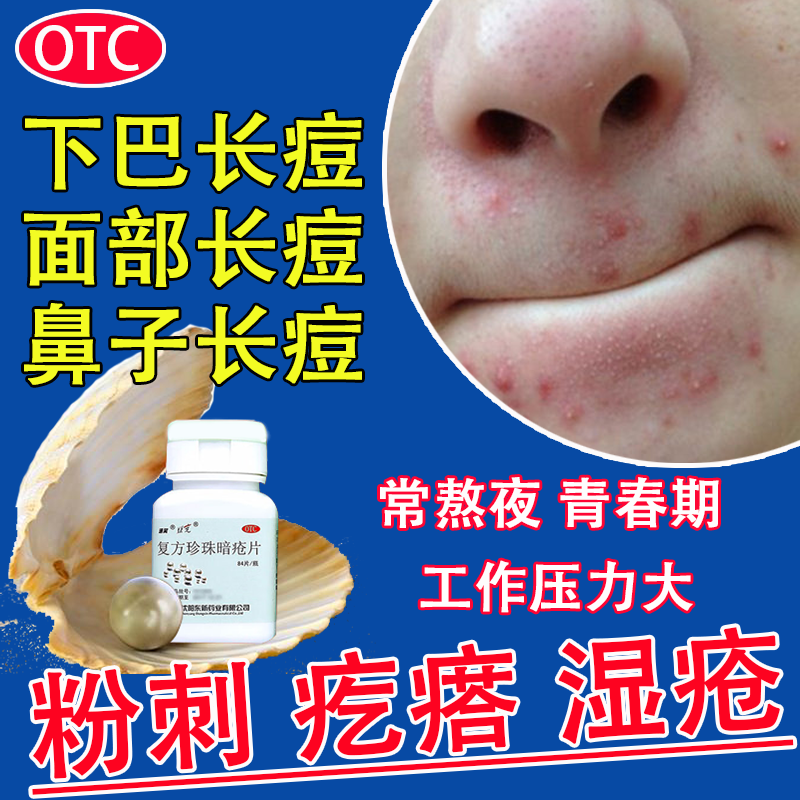 长痘痘青春痘熬夜长痘男女内分泌失调痘痘 中药调理 复方珍珠暗疮片 1