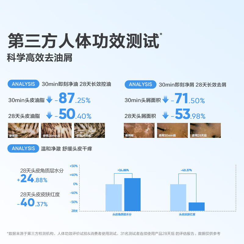 红色小象青少年去屑洗发水深层洁净控油学生女孩男大童洗发乳蓬松清爽止痒 【青少年专研】洗发水400g