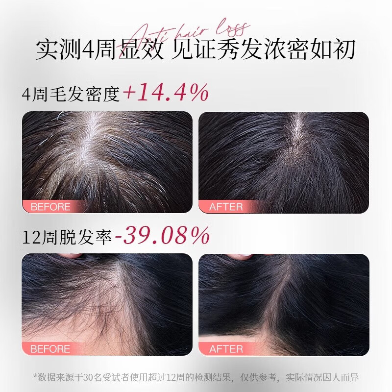 轻奢妍防脱洗发水官方旗舰防脱发固发防断发掉发强韧控油洗发露店 洗发水+白黑客防脱育发液 360ml